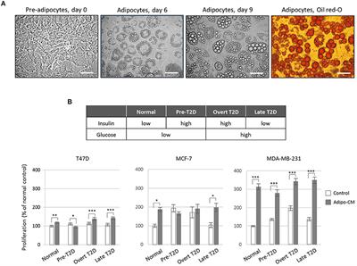 Adipocytes and Obesity-Related Conditions Jointly Promote Breast Cancer Cell Growth and Motility: Associations With CAP1 for Prognosis